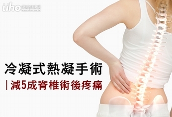 冷凝式熱凝手術 減5成脊椎術後疼痛
