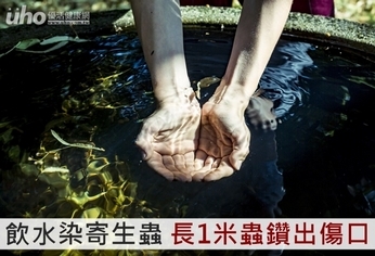 飲水染寄生蟲 長1米蟲鑽出傷口