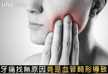 牙痛找無原因 竟是血管畸形導致