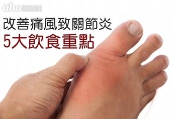 改善痛風致關節炎 5大飲食重點