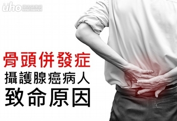 骨頭併發症 攝護腺癌病人致命原因!