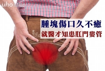 腫塊傷口久不癒 就醫才知患肛門瘻管