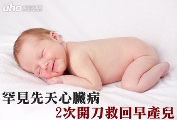 罕見先天心臟病　2次開刀救回早產兒