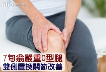 7旬翁嚴重O型腿 雙側置換關節改善