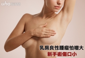 乳房良性腫瘤怕增大　新手術傷口小