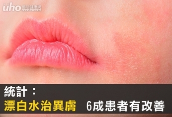 統計:漂白水治異膚 6成患者有改善