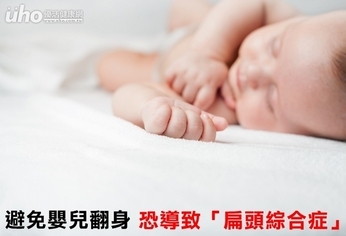 避免嬰兒翻身 恐導致「扁頭綜合症」