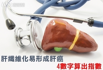 肝纖維化易形成肝癌 4數字算出指數