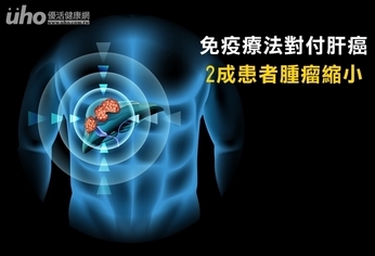 免疫療法對付肝癌 2成患者腫瘤縮小