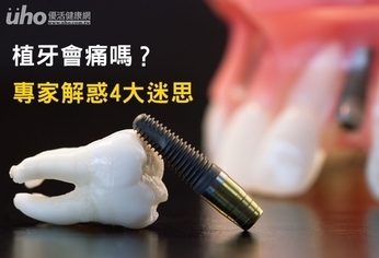 植牙會痛嗎?專家解惑4大迷思