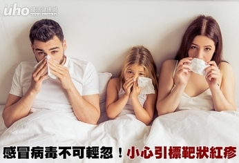 感冒病毒不可輕忽!小心引標靶狀紅疹