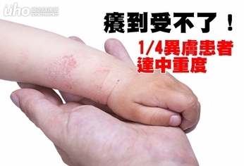 癢到受不了!1/4異膚患者達中重度