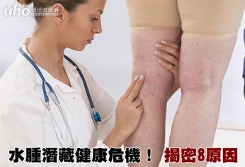 水腫潛藏健康危機!揭密8原因