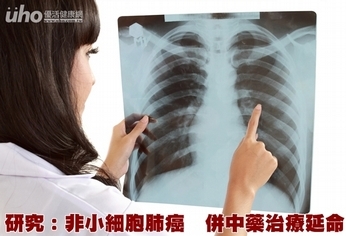 研究：非小細胞肺癌　併中藥治療延命