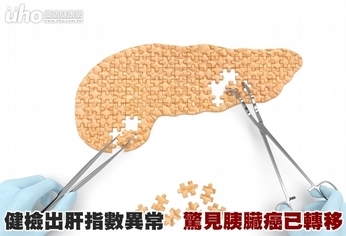 健檢出肝指數異常　驚見胰臟癌已轉移