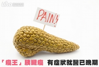 「癌王」胰臟癌 有症狀就醫已晚期