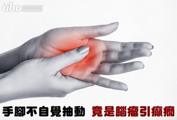 手腳不自覺抽動 竟是腦瘤引癲癇