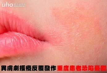 異膚搔癢反覆發作 重度患者恐陷憂鬱