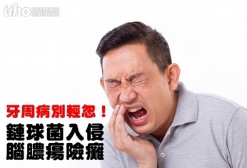 牙周病別輕忽!鏈球菌入侵腦膿瘍險癱