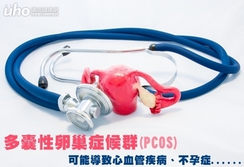 多囊性卵巢症候群 恐導致心血管疾病