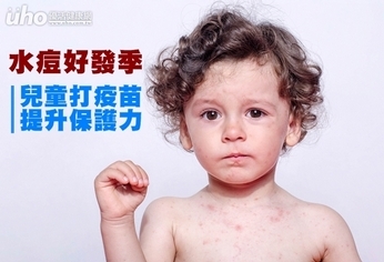 水痘好發季　兒童打疫苗提升保護力