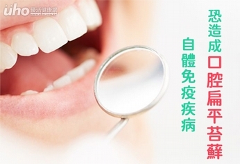 自體免疫疾病 恐造成口腔扁平苔蘚