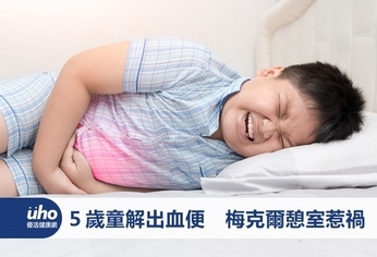 5歲童解出血便 梅克爾憩室惹禍