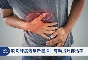 晚期肝癌治療新選擇 有助提升存活率