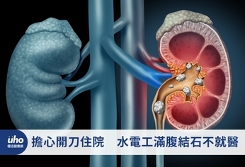 擔心開刀住院　水電工滿腹結石不就醫