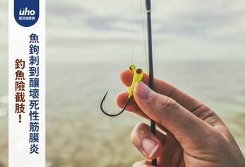 釣魚險截肢!魚鉤刺到釀壞死性筋膜炎