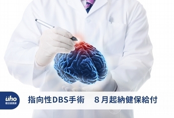 指向性DBS手術　８月起納健保給付