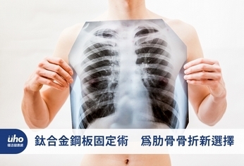 鈦合金鋼板固定術 為肋骨骨折新選擇