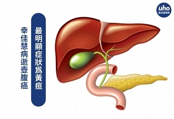 幸佳慧病逝壺腹癌　最明顯症狀為黃疸