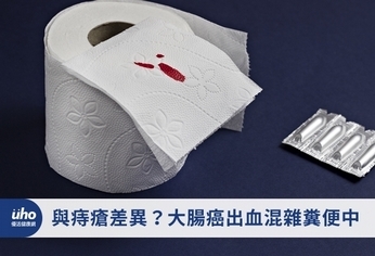 重視異常出血!大腸癌出血混雜糞便中