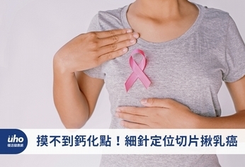 摸不到鈣化點!細針定位切片揪乳癌