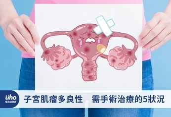 子宮肌瘤多良性 需手術治療的5狀況