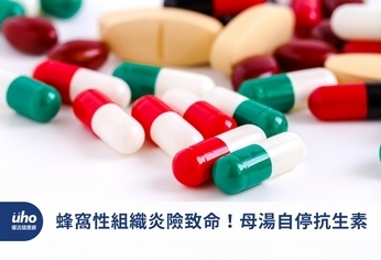 蜂窩性組織炎險致命!母湯自停抗生素