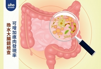 換水大腸鏡檢查　可增加瘜肉發現率