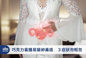 巧克力囊腫易變卵巢癌 3症狀勿輕忽