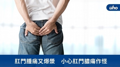 肛門腫痛又爆漿 小心肛門膿瘍作怪