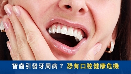 智齒引發牙周病？　恐有口腔健康危機