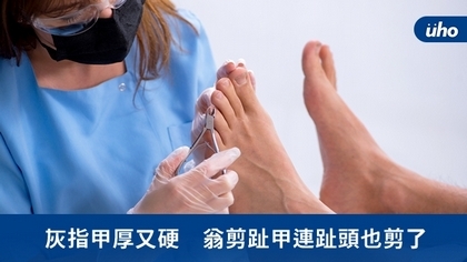 灰指甲厚又硬 翁剪趾甲連趾頭也剪了