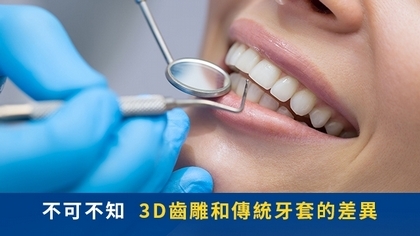 不可不知 3D齒雕和傳統牙套的差異
