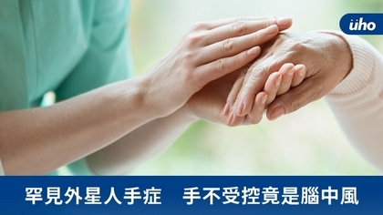罕見外星人手症 手不受控竟是腦中風