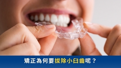矯正為何要拔除小臼齒呢?
