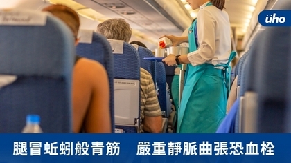 腿冒蚯蚓般青筋 嚴重靜脈曲張恐血栓