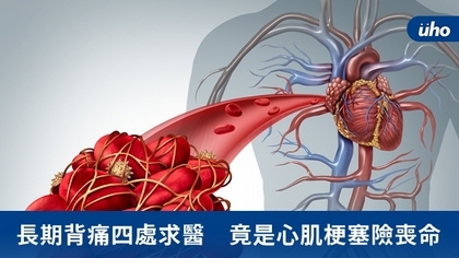 長期背痛四處求醫　竟是心肌梗塞險喪命