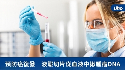 預防癌復發　液態切片從血液中揪腫瘤DNA