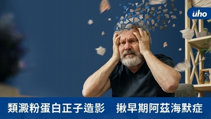 類澱粉蛋白正子造影 揪早期阿茲海默症