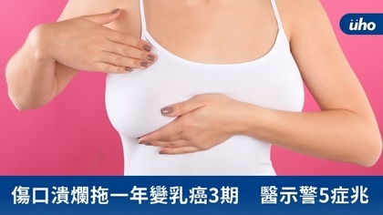 傷口潰爛拖一年變乳癌3期　醫示警5症兆